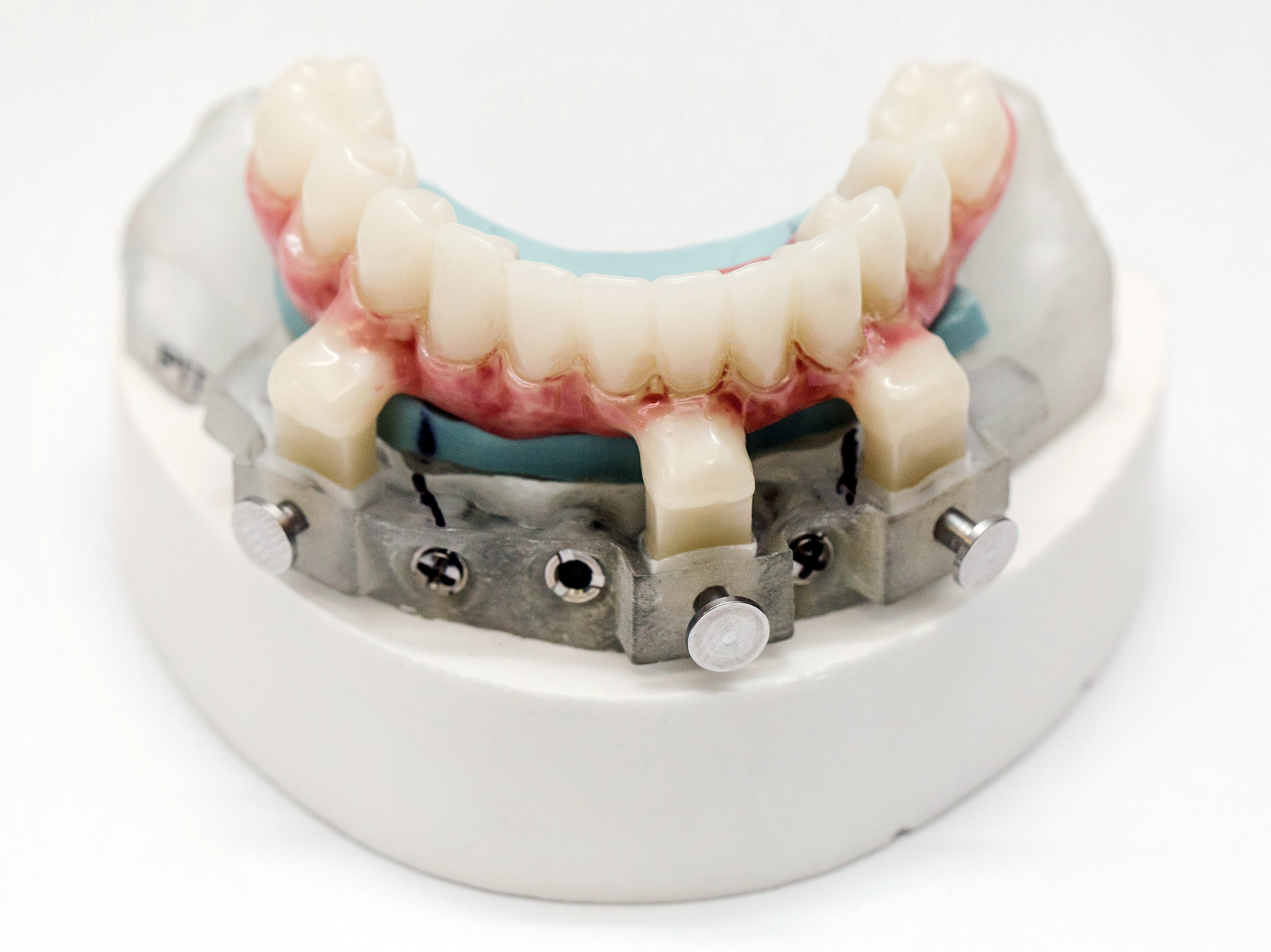 Surgical Guides Pittman Dental Laboratory